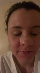 Michelle with breathe right strip on her nose