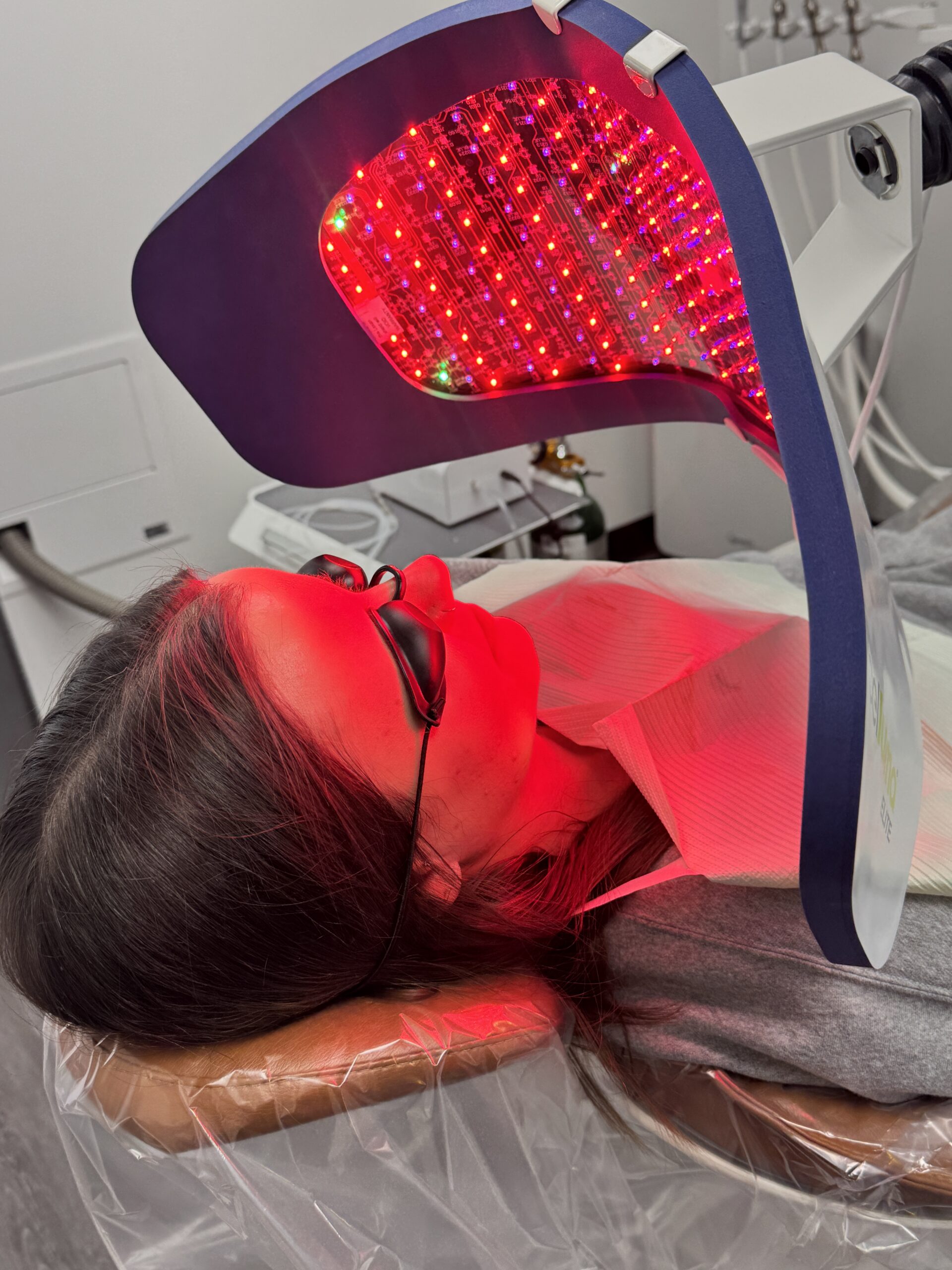 Dental Infections, Root Canals & Cavitations: 3 Hidden Causes of Acne, Sinus Issues & Inflammation